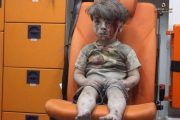 Five-year-old Syrian Omran Daqneesh